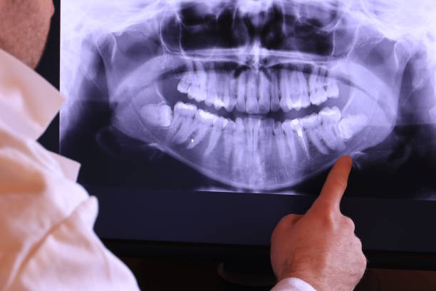 Best Emergency Wisdom Tooth Extraction in Waipio Acres, HI